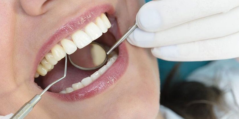 Dental implants are now painless, affordable