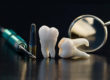 Benefits of All-on-4 Dental Implants?
